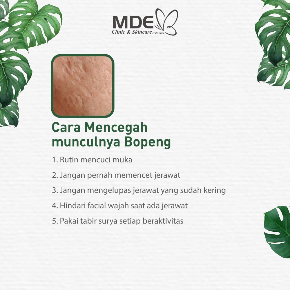 Blog Single